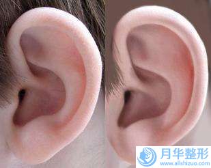 成人漏斗胸矯正厲害的醫(yī)生全國：成人漏斗胸矯正醫(yī)生top50強口碑曝光