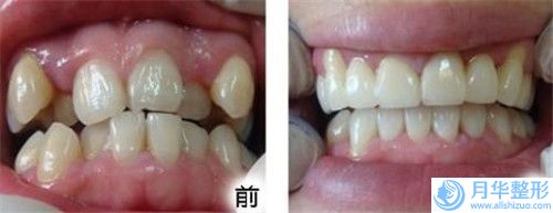 揭陽(yáng)溶脂減肥手術(shù)術(shù)的收費(fèi)是多少錢