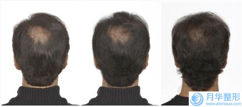 白城薇斯醫(yī)療美容門診部大瘦臉針價錢多少
