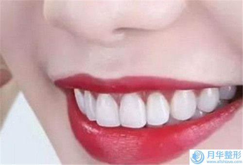 巴音郭楞優(yōu)立塑瘦身會(huì)出現(xiàn)什么后遺癥呢