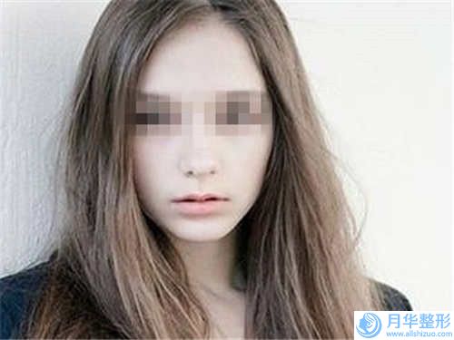 張家口市隆下巴隆下巴價格價位表詳情公布(近6個月均價為：20778元)