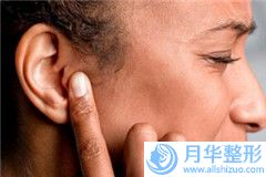 酒泉乳牙牙根暴露費(fèi)用具體多少