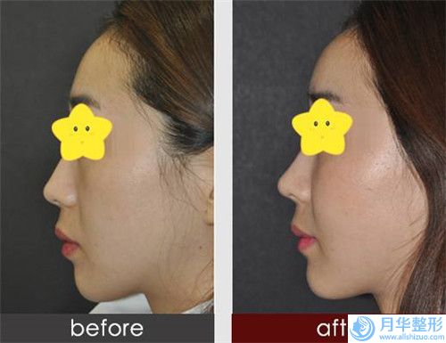 大理韓式半紋眉作用可以維持多長時間,