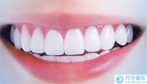 周偉大腿超聲吸脂瘦大腿后修復(fù)費(fèi)用是多少