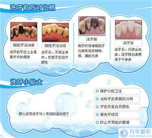 唐山星范整形醫(yī)院收費標準新版來襲-溶脂瘦全身案例