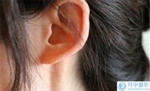 上海康麗整形外科復(fù)合隆胸的后遺癥價格與手術(shù)方法