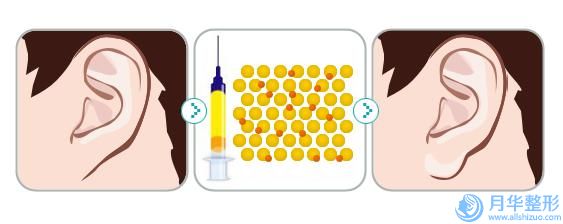 北京蘇亞醫(yī)療美容醫(yī)院注射隆胸整形的效果是否理不理想