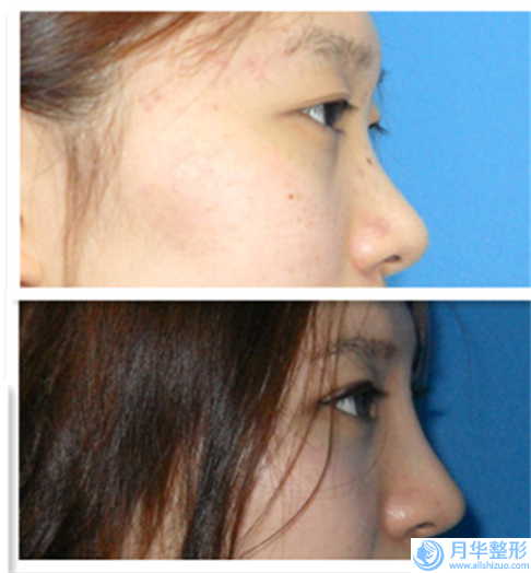 國內(nèi)出名的鼻部整型美容醫(yī)生：鼻部整型美容醫(yī)生前50強(qiáng)公立匯總