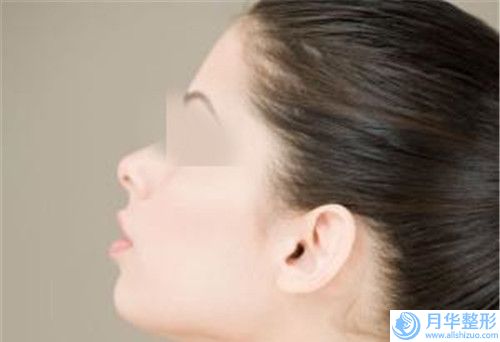 做胸部整形手術(shù)術(shù)后護理都應(yīng)該注意什么事情