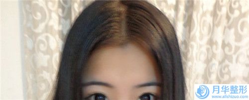 北海溶脂瘦臉手術價格一覽