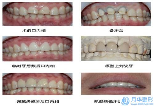 宿州瘦身塑形有什么安全隱患-宿州瘦身塑形的安全受什么因素影響