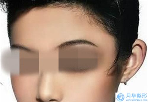撫州美容整形隆胸的費用是怎么樣的
