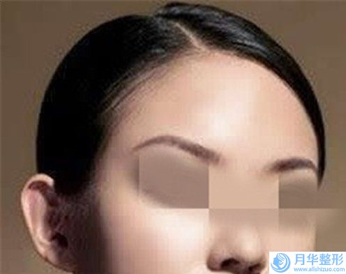 哈爾濱市整形切除副乳醫(yī)生在榜清單人氣高漲-蘇明山整形醫(yī)生大熱門啊