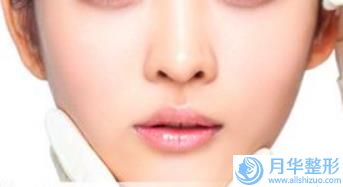 史娟娟腐蝕療法治療雀斑矯正的術(shù)后護(hù)理重點(diǎn)是什么