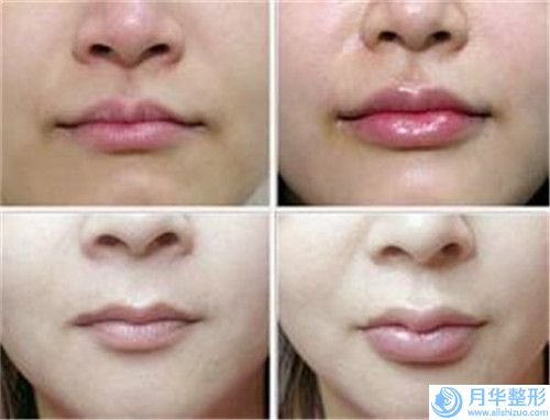 國內牙齒咬合不齊下巴后縮好的醫(yī)生是誰：牙齒咬合不齊下巴后縮醫(yī)生50強較新收錄