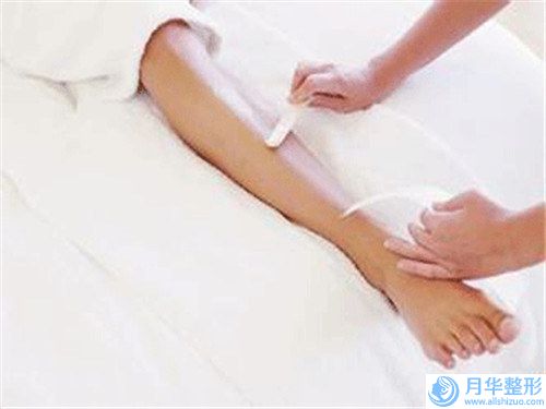 榆林瘦臉去咬肌主要適用哪些群體