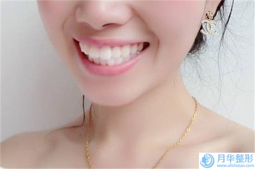 武漢市整形瘦小腿手術(shù)醫(yī)院上榜名單top10強(qiáng)全新分享-武漢鵬愛醫(yī)靜港療美容門診部