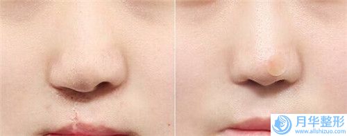 貴州省手術(shù)假體隆下巴專業(yè)醫(yī)院推薦：手術(shù)假體隆下巴醫(yī)院前30強花名冊一覽