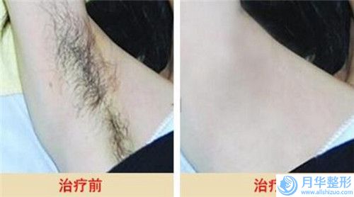 成都市整容臉型矯正價格(價目)表來了(整容臉型矯正價錢一般是多少)