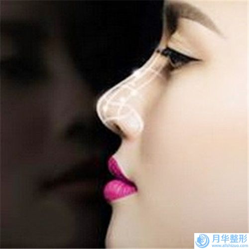 西安市塌鼻矯正手術(shù)價(jià)格(收費(fèi)標(biāo)準(zhǔn))超全速看-近8個(gè)月均價(jià)為2867元