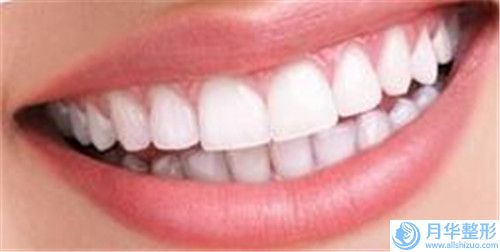 激光去脂肪粒手術(shù)會(huì)有風(fēng)險(xiǎn)出現(xiàn)嗎