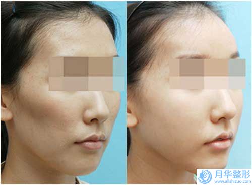 俞良鋼3d立體眉的價位大概是多少