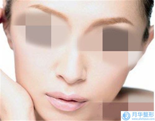 玻尿酸來(lái)隆鼻之后的后期護(hù)理