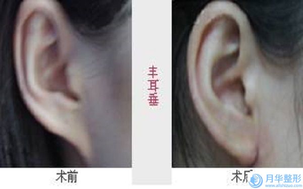 蕪湖市注射隆胸豐胸價目表一覽新出-蕪湖伊萊美整形外科醫(yī)院醫(yī)療美容醫(yī)院價格范圍是多少