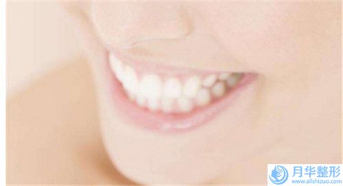 全身吸脂手術(shù)的費(fèi)用會(huì)不會(huì)很貴