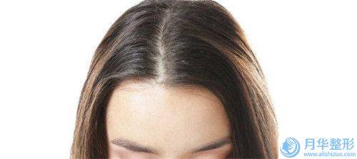 玻尿酸填充面頰手術(shù)的費(fèi)用如何呢