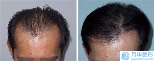 金宥嬋醫(yī)生咬肌變小瘦臉案例-價(jià)格(價(jià)目)表滿意度到底好不好