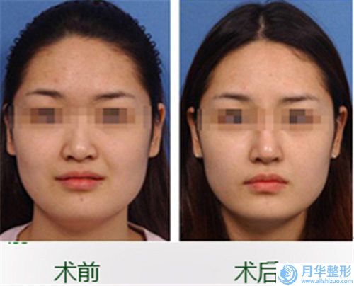 贛州市人民醫(yī)院美容整形科收費(fèi)明細(xì)隆重發(fā)布-擅長項(xiàng)目鼻綜合整形手術(shù)等