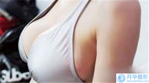 豐額術(shù)以后會(huì)不會(huì)影響排汗