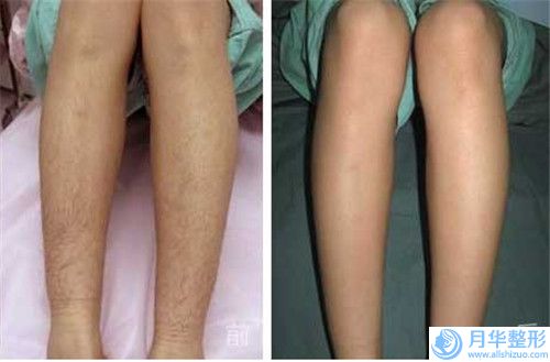 中國整形微整瘦臉哪個醫(yī)生良好：微整瘦臉醫(yī)生top50強已出爐