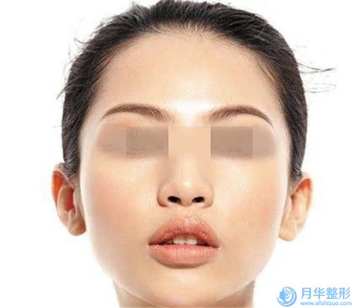 自體脂肪隆下巴手術(shù)術(shù)比較長能保持多長時間