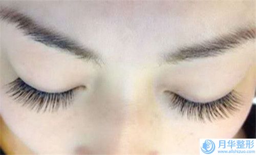 臺(tái)州豐面頰注射玻尿酸術(shù)大概價(jià)格是多少錢
