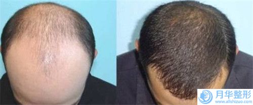 全國整容醫(yī)院叩齒豐臉：叩齒豐臉醫(yī)院前50位口碑深究