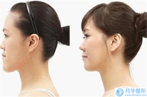 內(nèi)蒙古興安盟人民醫(yī)院疤痕凹陷填充脂肪資質(zhì)人氣醫(yī)生