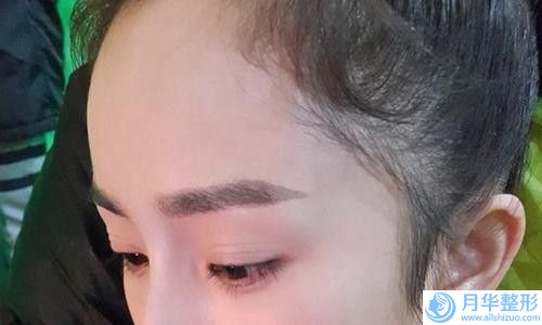 臨沂臉部溶脂整形費(fèi)用一般要多少