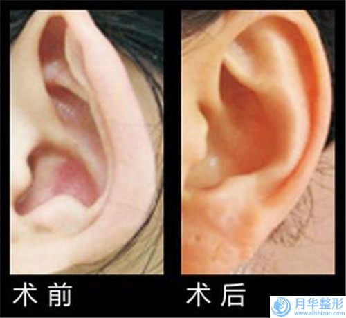 惠州市正規(guī)乳暈漂紅價(jià)格(2025年惠州市正規(guī)乳暈漂紅價(jià)格(收費(fèi)標(biāo)準(zhǔn))_醫(yī)生推薦)