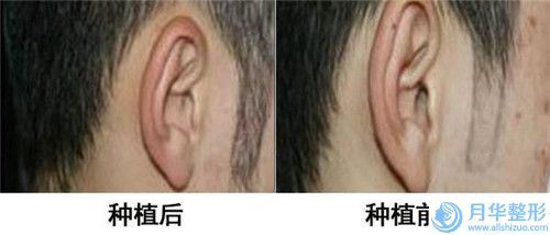 中國蛋白線面部提升醫(yī)院推薦：蛋白線面部提升醫(yī)院前50佳深度測(cè)評(píng)