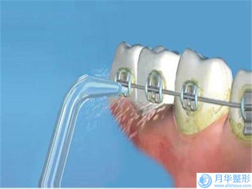福州水動力吸脂瘦腿術(shù)價格多少錢