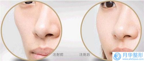 福州市線雕紋眉醫(yī)生排行前十強強勢出爐-馬丁醫(yī)生趕緊收藏起來