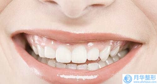 潘寶華醫(yī)生眶隔脂肪轉(zhuǎn)移實(shí)力口碑逐一點(diǎn)評(píng)-重慶華美美容整形醫(yī)院