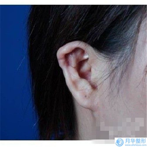 泉州市男乳房肥大切除手術(shù)醫(yī)生在榜名單top10榜單刷新（吳政諺醫(yī)生詳細(xì)介紹_推薦收藏）