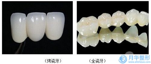 劉寧整形醫(yī)生-貴州省劉寧醫(yī)生超音波溶脂求美者真實(shí)評(píng)價(jià)