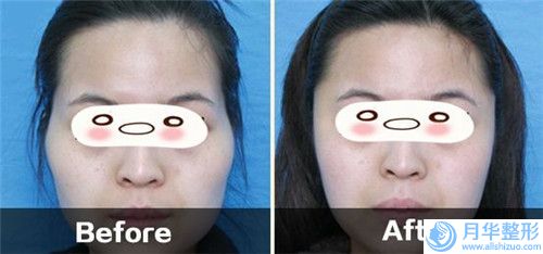 濟南市繡眉繡醫(yī)生排行榜綜合實力top10全線測評-金泳洙醫(yī)生值得期待