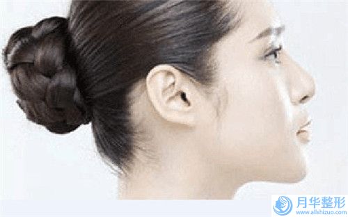 宜昌市乳頭凹陷造成治療醫(yī)生排名榜是好選擇-吳曉蔚醫(yī)生實(shí)力優(yōu)異