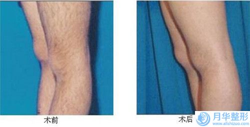 曲靖市臉部瘦身吸脂醫(yī)生在榜清單整形院長(zhǎng)醫(yī)生大全-路秀波醫(yī)生解鎖榜前三