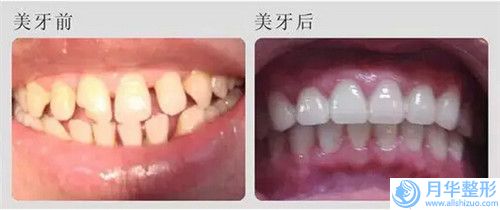上海市做射頻溶脂瘦臀部好的醫(yī)院(上海交通大學(xué)醫(yī)學(xué)院附屬瑞金醫(yī)院?整形美容科分榜首竟被他拿下)